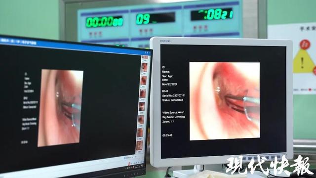 险！核桃仁呛入1岁男宝气管(图2)