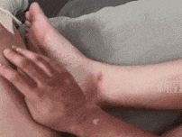 孩子手、脸都被烧伤！这种玩具千万别买(图2)